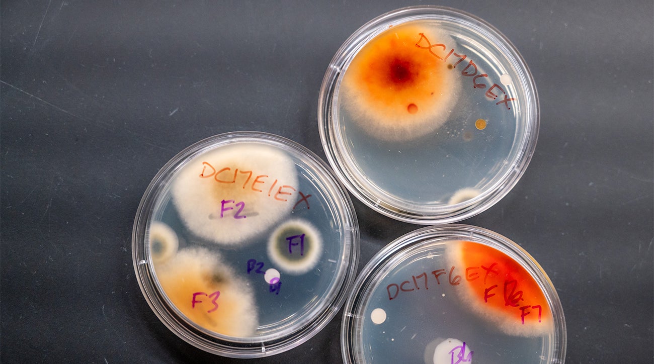 Petri dishes with bacteria inside
