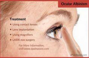 Using contact lenses, lens implantation, using magnifiers, LASIK eye surgery