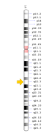 diagram of gene with mutation location marked