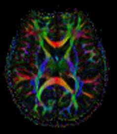 Colorful image of a brain