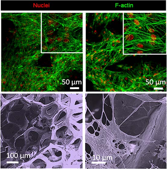 Frahs_GF-w-Cells