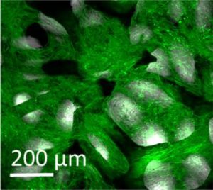 Mechanical Properties of Graphene Foam